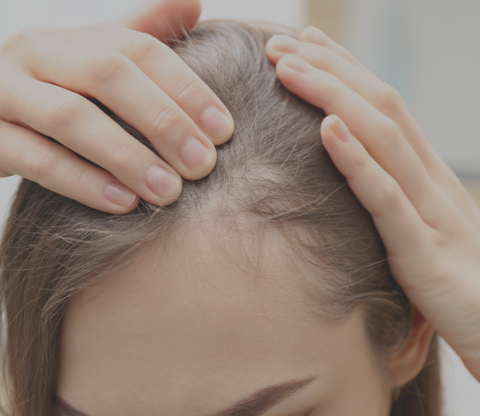 <h1>Hair Loss Treatments at Murakami Medical Centre</h1>