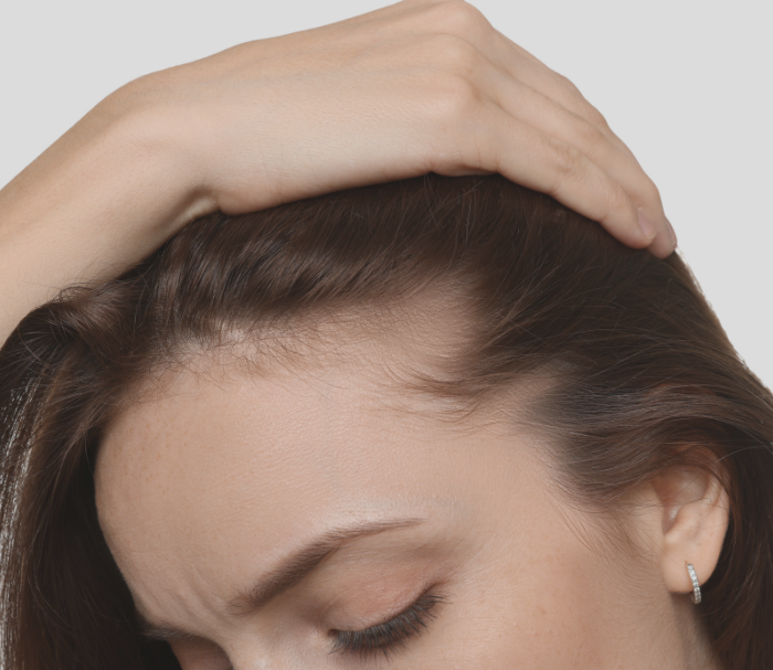 <h1>Hair Growth & Regrowth Treatments at Murakami Medical Centre</h1>