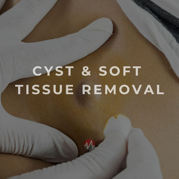 Cyst & Soft Tissue Removal