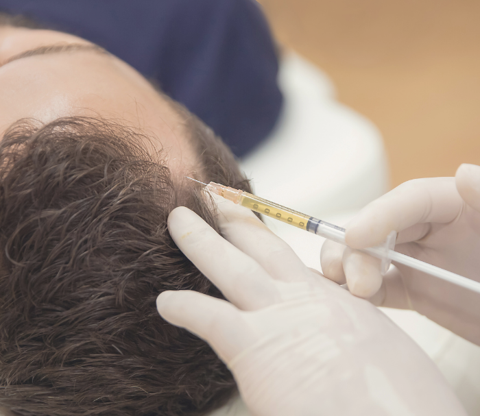 <h1>Hair Loss Treatments at Murakami Medical Centre</h1>