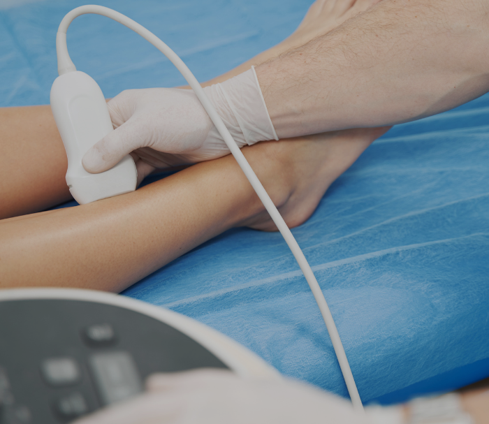 <h1>Private Vascular & Circulation Ultrasound Scan in Hampstead, London</h1>